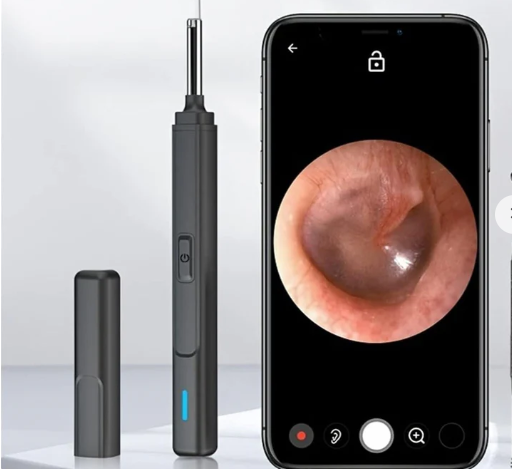 Otoscópio digital com visualização em tempo real no smartphone